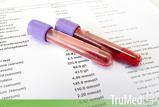 thyroid-testing-report