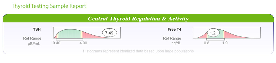 Natural Adrenal and Thyroid Testing Panel Sample