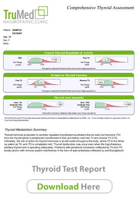 Thyroid Report Sample